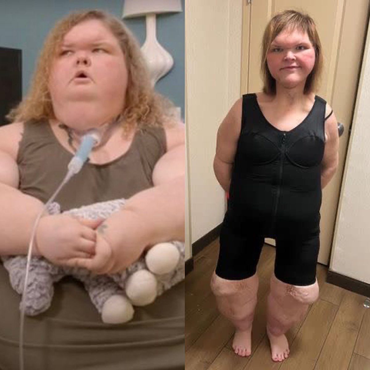 CerfiaFR's tweet image. 🇺🇸 FLASH | La célèbre américaine Tammy Slaton, qui avait participé à l’émission "1000-Lb Sisters", dévoile son impressionnante évolution après la perte de ~230kg et d’une opération pour retirer son excès de peau.