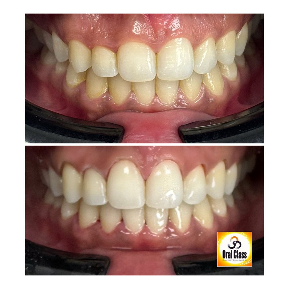 OralClass centro dental tweet media