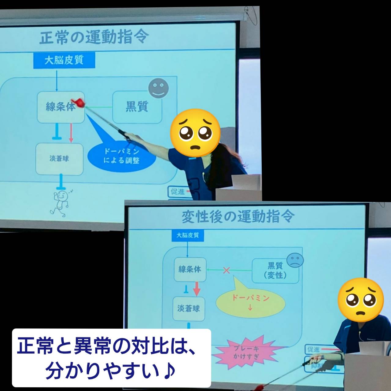 中枢神経様 リクエスト 4点 まとめ商品 中枢神経系用薬 商品一覧｜Family Pharmacy Global