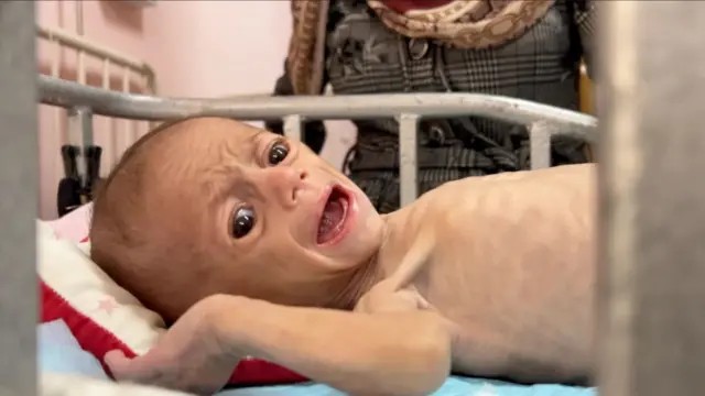 JaimeMercant's tweet image. Los ataques despiadados del monstruo genocida del Estado de Israel deja estas cifras aproximadas:

- 60.000 muertos (18.000 niños).
- 140.000 heridos.
- 15.000 desaparecidos.

Las ayudas humanitarias son simplemente una parodia. Son muchas las personas que mueren de desnutrición…