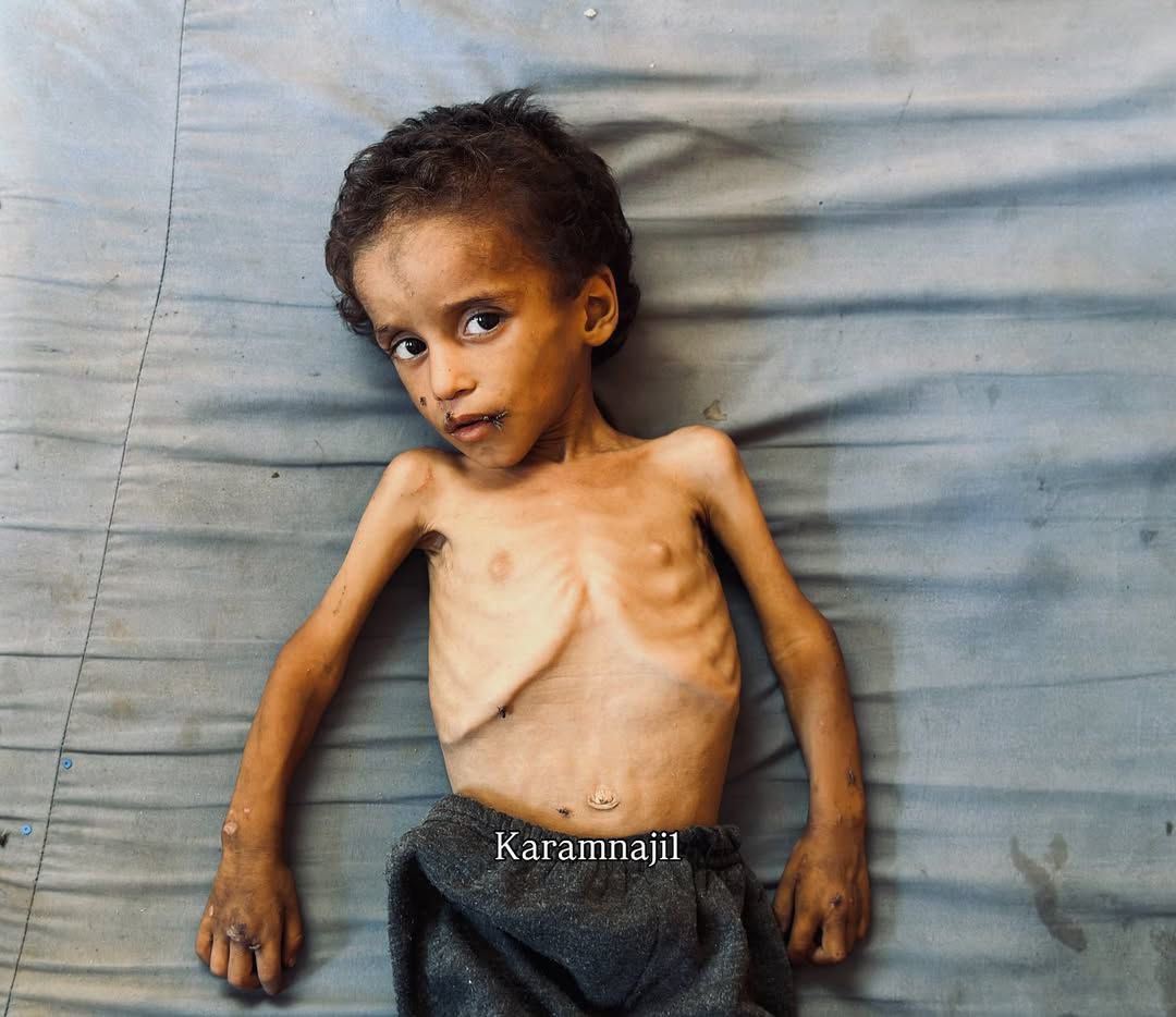Mohammadvalineg's tweet image. قال طفل في غزة: في الآخرة، أسأل رسول الله أن لا يشفع لأحد ممن استطاع ولم ينصرنا.
#غزه_تموت_جوعاً
