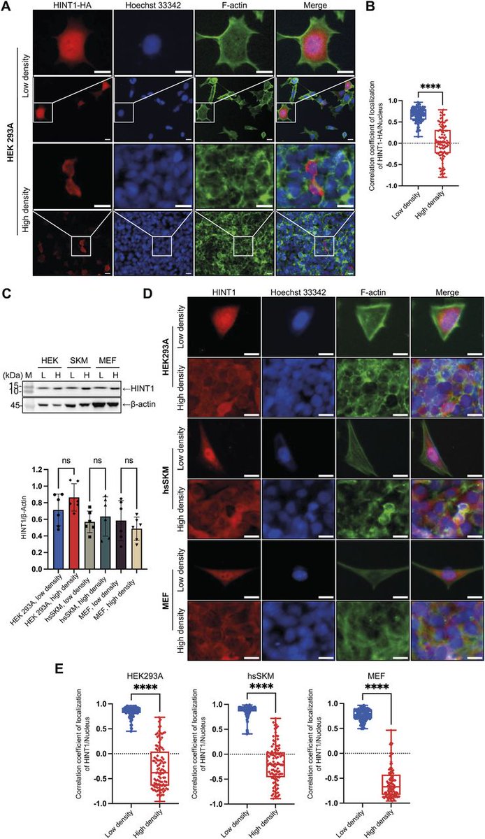LSAjournal's tweet image. HINT1's density-dependent shuttling regulates nuclear transcription at low density and cytoplasmic actin remodeling at high density. life-science-alliance.org/content/8/10/e…