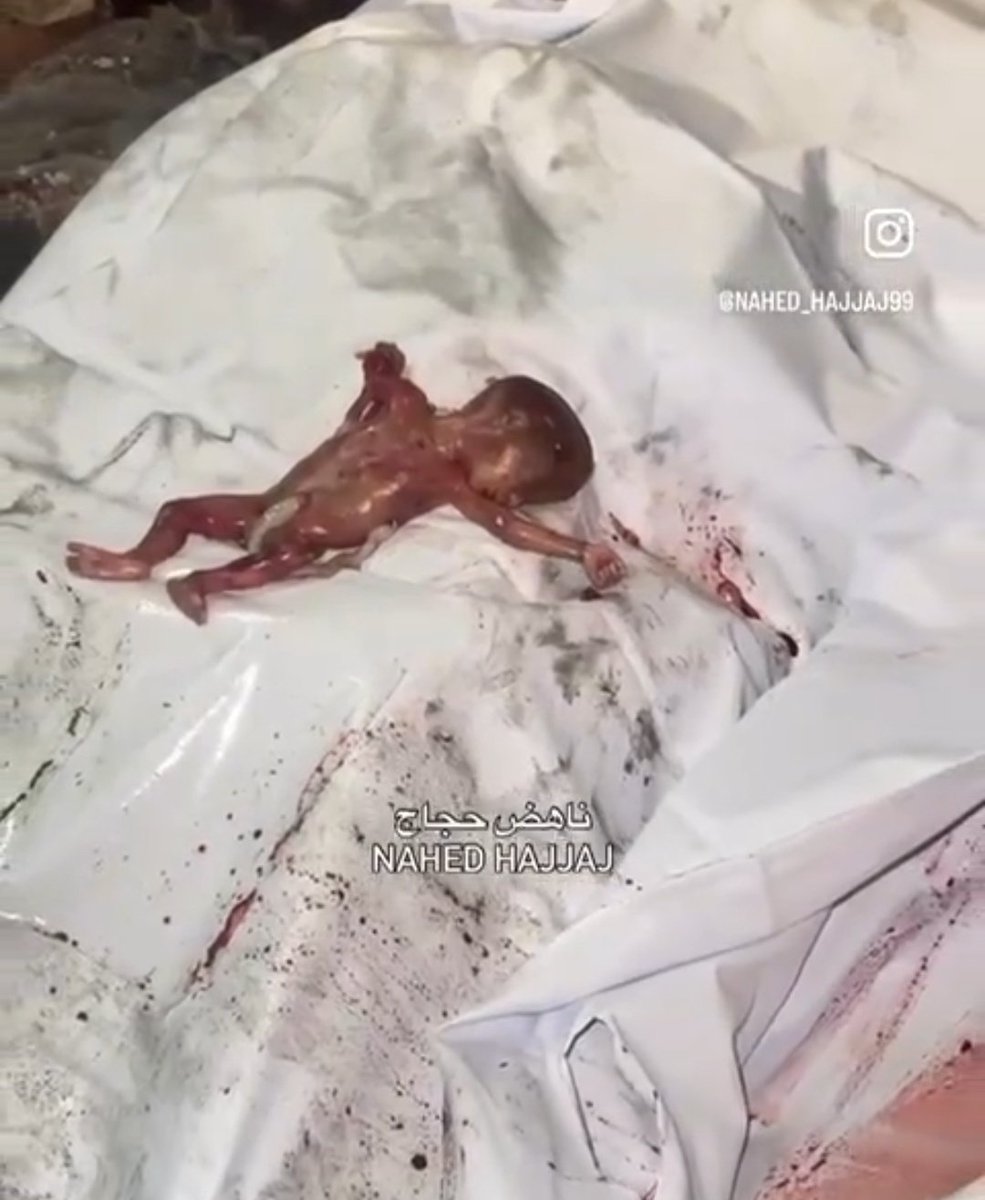 Sarbazm_ir_'s tweet image. اولین شهید جنین با آتش زدن در خانه حضرت زهرا رخ داد.
قاتلان امروز از نسل قاتلان دیروز هستن.
#غزه_تموت_جوعاً
#غزه_تباد_وتحرق