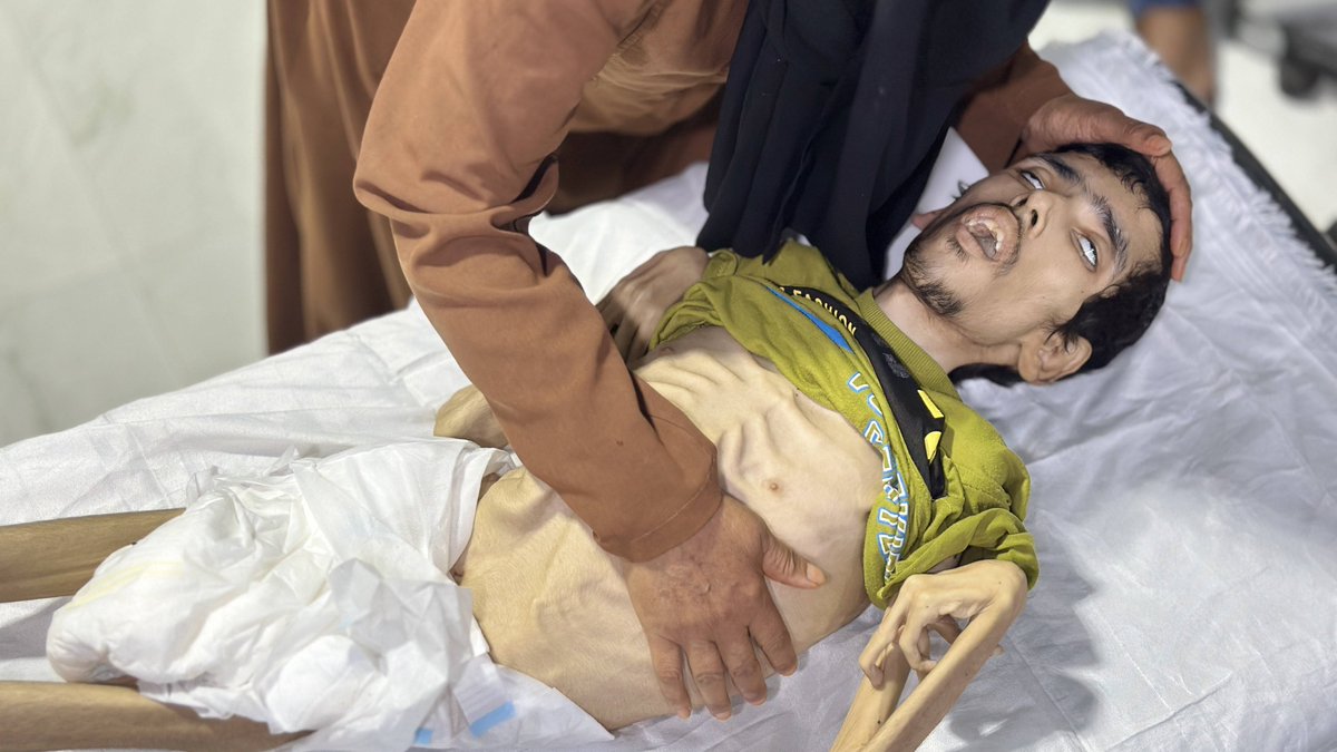jungewelt's tweet image. »In vier Jahrzehnten hat es keinen Fall einer derart minutiös ausgearbeiteten, genau überwachten und präzise konzipierten Massenaushungerung einer Bevölkerung gegeben, wie es heute in Gaza geschieht.«
Alex de Waal, Direktor der World Peace Foundation
jungewelt.de/artikel/504573…