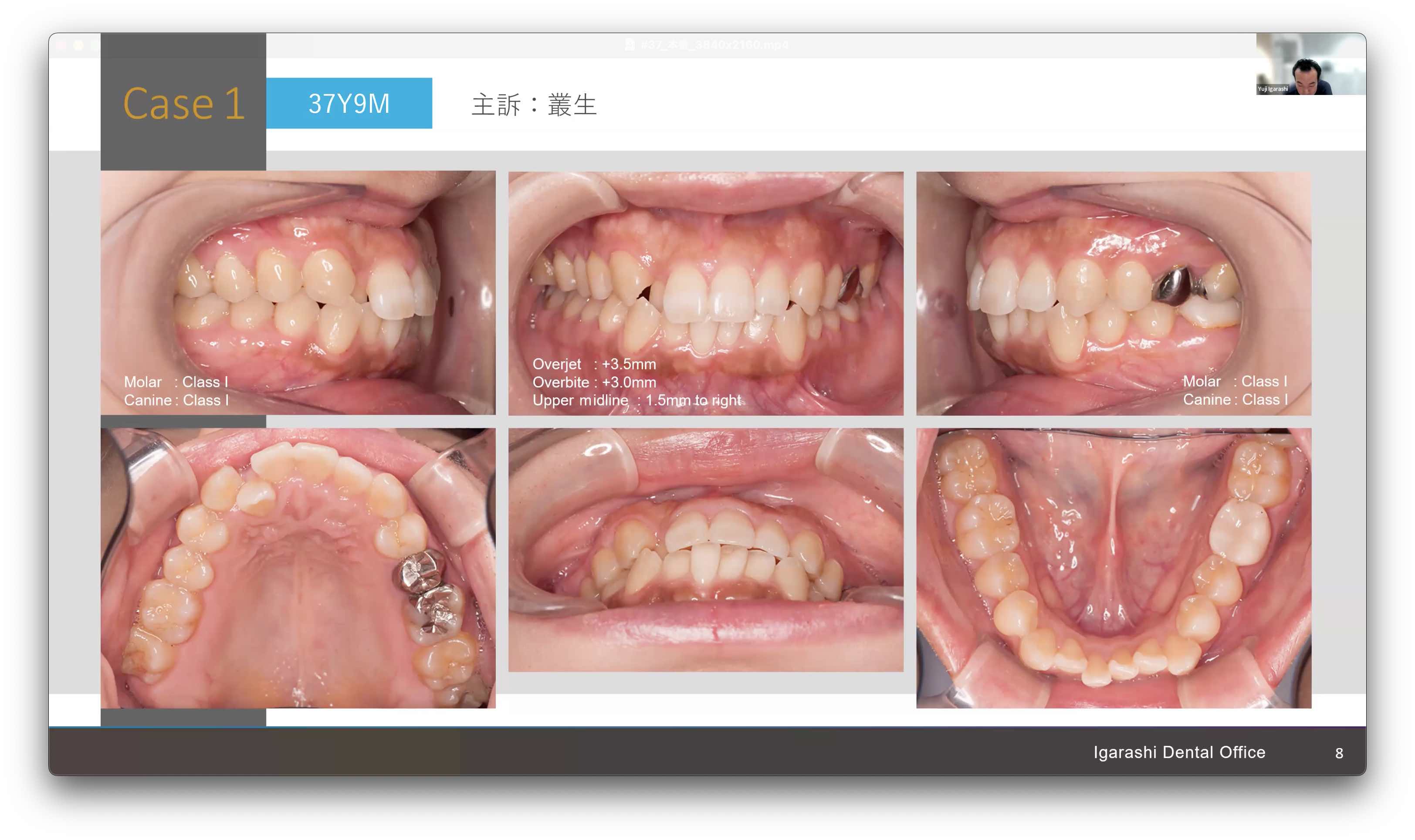201 Study Club Orthodontic Brains 矯正治療 本郷さくら矯正歯科 HONGO SAKURA ORTHODONTIC TOKYO