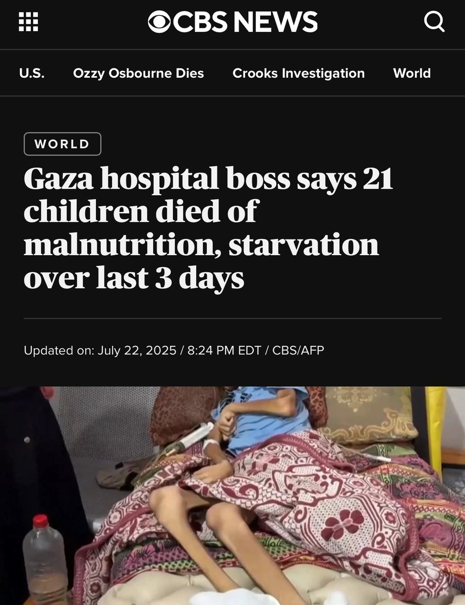 awgaffney's tweet image. Of course children are dying of starvation. That’s what happens when you starve people. They die.