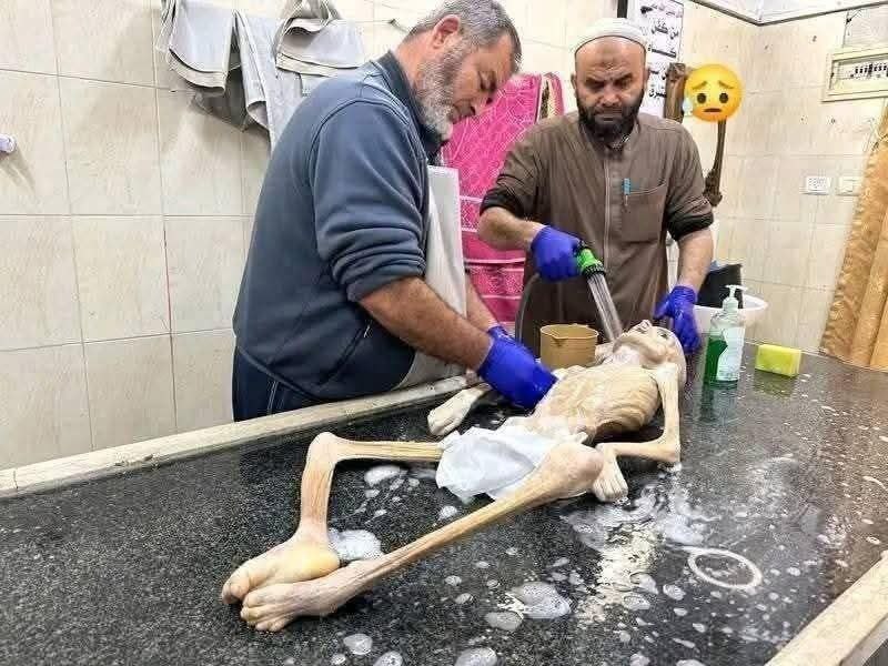 Alimohamadi1376's tweet image. ثمره این ظلم ها قطعا آزادی مردم فلسطین است.
#غزه_تموت_جوعاً