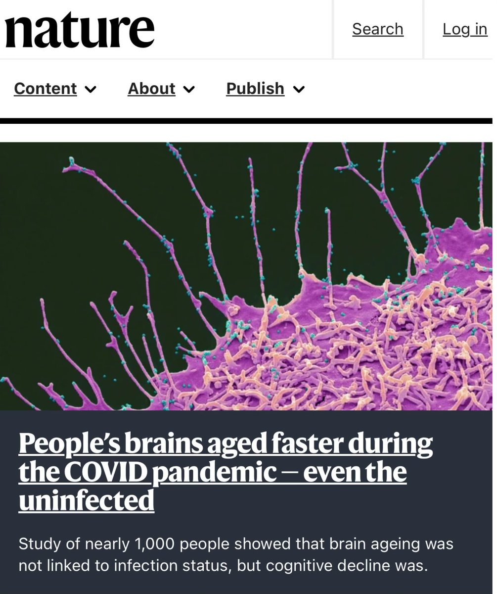 Fil 🧵 🧠 La pandémie a vieilli nos cerveaux

Une grande étude britannique (UK Biobank, ~1000 adultes sains) révèle que la pandémie COVID-19 a accéléré le vieillissement du cerveau, même sans infection.
Résultat : un cerveau « plus vieux » de 5,5 mois en moyenne par rapport à