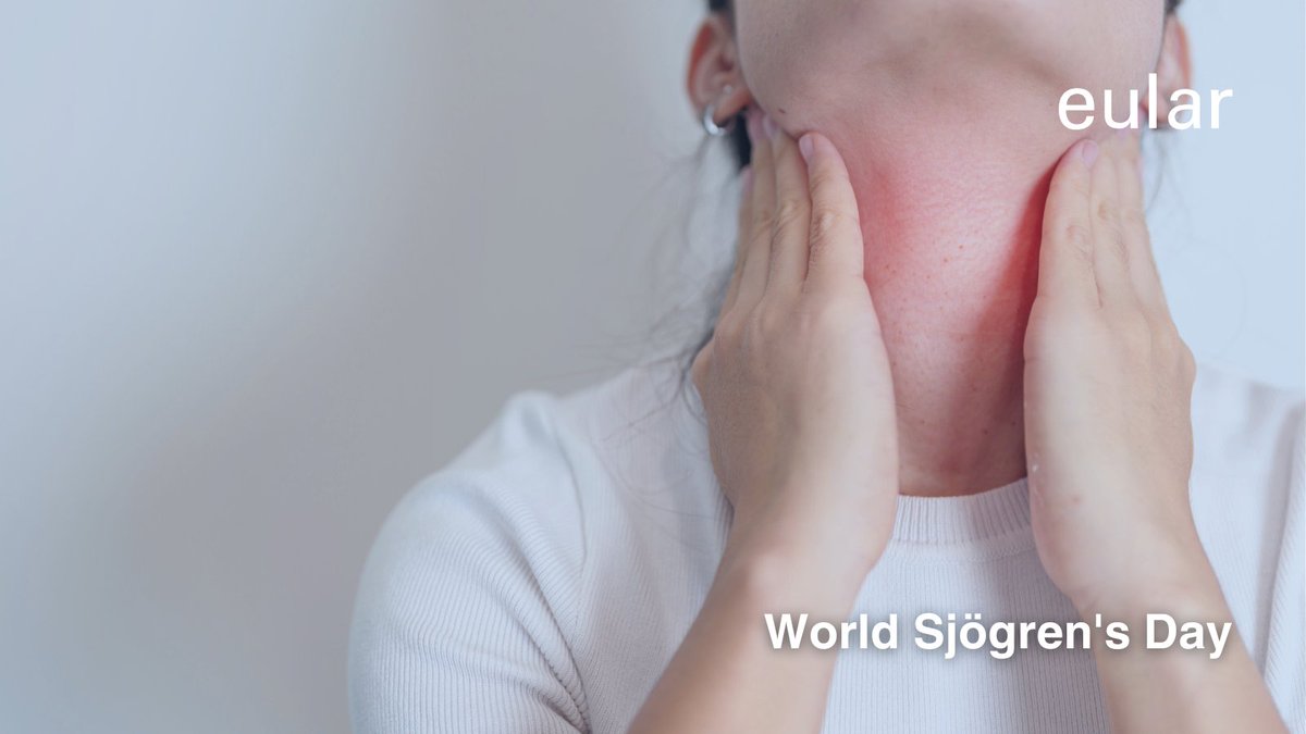 eular_org's tweet image. 📢 It´s World Sjögren's Day!
Let’s bring attention to Sjögren's syndrome, an autoimmune condition that causes dry mouth, dry eyes, fatigue. Raising awareness can help improve diagnosis, management, support for those living with this challenging condition.
#eularADVOCACY #EULAR