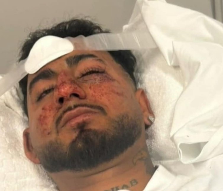 VoxShadabKhan's tweet image. THREAD🧵 | “F*Off, Indian”: Charanpreet Singh Brutally Assaulted in Racist Attack in Australia. Read till end👇