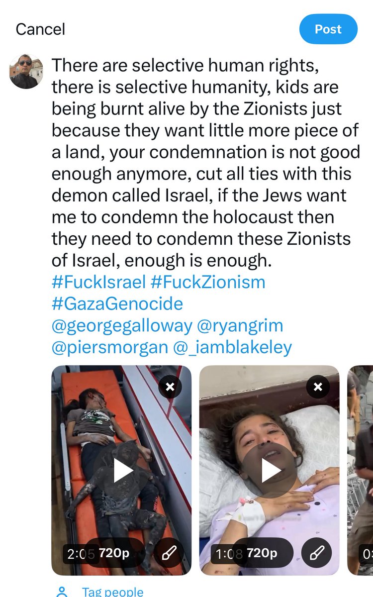 NaiKaroYar's tweet image. X won’t let me share the videos of burning children in Gaza, I tried more than a dozen times, Free speech right @elonmusk?