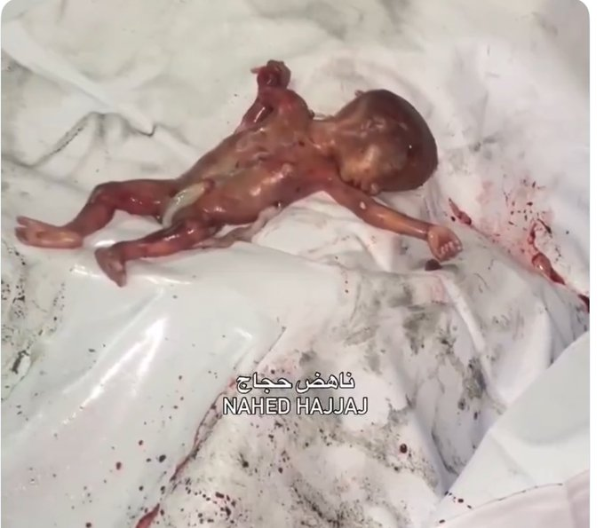 Almeqdad's tweet image. Pregnant journalist Walaa Al-Jaabari, her unborn baby, her husband, and their children were all killed in an Israeli airstrike that targeted their apartment in the Tel Al-Hawa neighborhood of #Gaza City.
