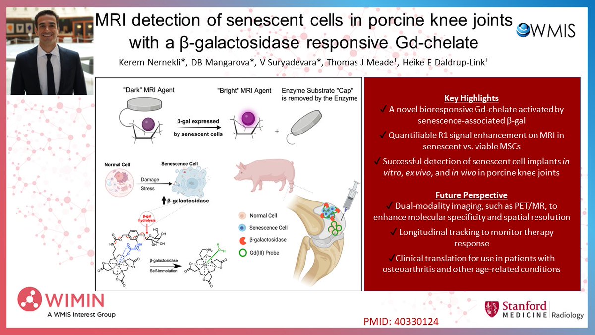 WIMIN_WMIS's tweet image. Just out from Dr. Heike E. Daldrup-Link’s lab! Led by Dr. @KeremNernekli, this study unveils a smart Gd-based MRI agent that lights up senescent cells in vivo—a major step for aging &amp;amp; OA imaging. pubmed.ncbi.nlm.nih.gov/40330124/ 
#MRI #MolecularImaging #AgingResearch #Osteoarthritis