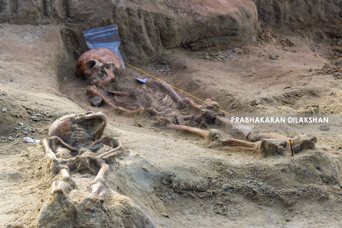 Prabhakaranlk's tweet image. During today’s excavation at the Chemmani human grave site in jaffna , five additional sets of human remains have been newly identified.
With this, the total number of human skeletal remains identified at the Chemmani grave site has increased to 85 #chemmani #chemmanimassgrave