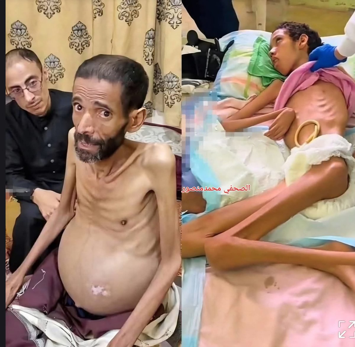 Anyone know where these pix originated from ..
<a href="/GAZAWOOD2/">gazawood2</a> 
Dr in Gaza claimed them to be from Gaza, 
But one is supposedly from Syria . #gazawood