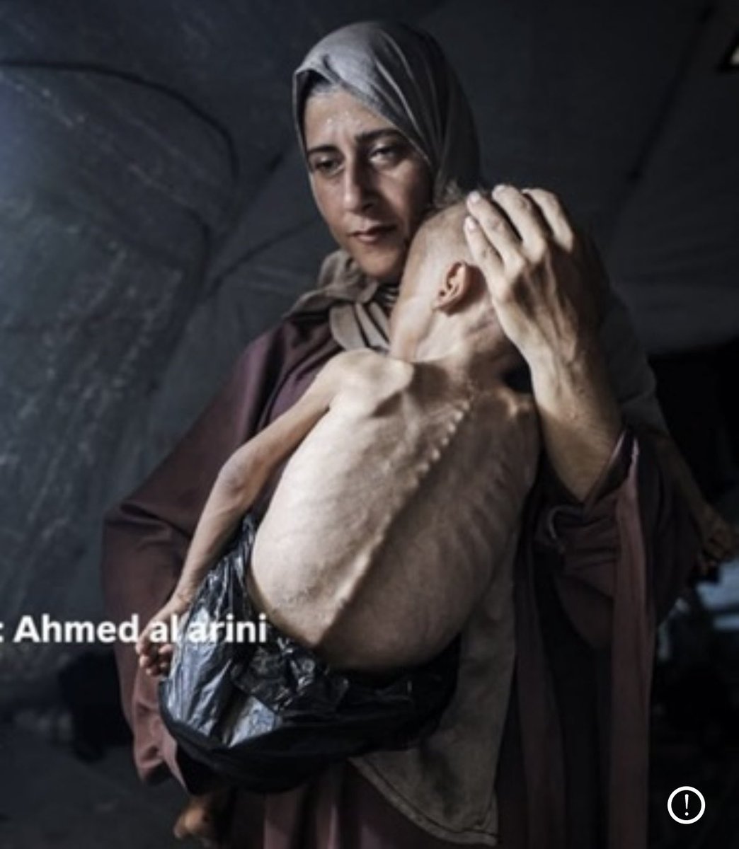ZainAbbadi11's tweet image. 🚨 Palestinian Ministry of Health in Gaza:
Hospitals in the Gaza Strip recorded 10 new deaths due to famine and malnutrition in the Gaza Strip during the past 24 hours.
The total number of deaths due to famine and malnutrition has reached 111.
Ministry of Health
July 23, 2025