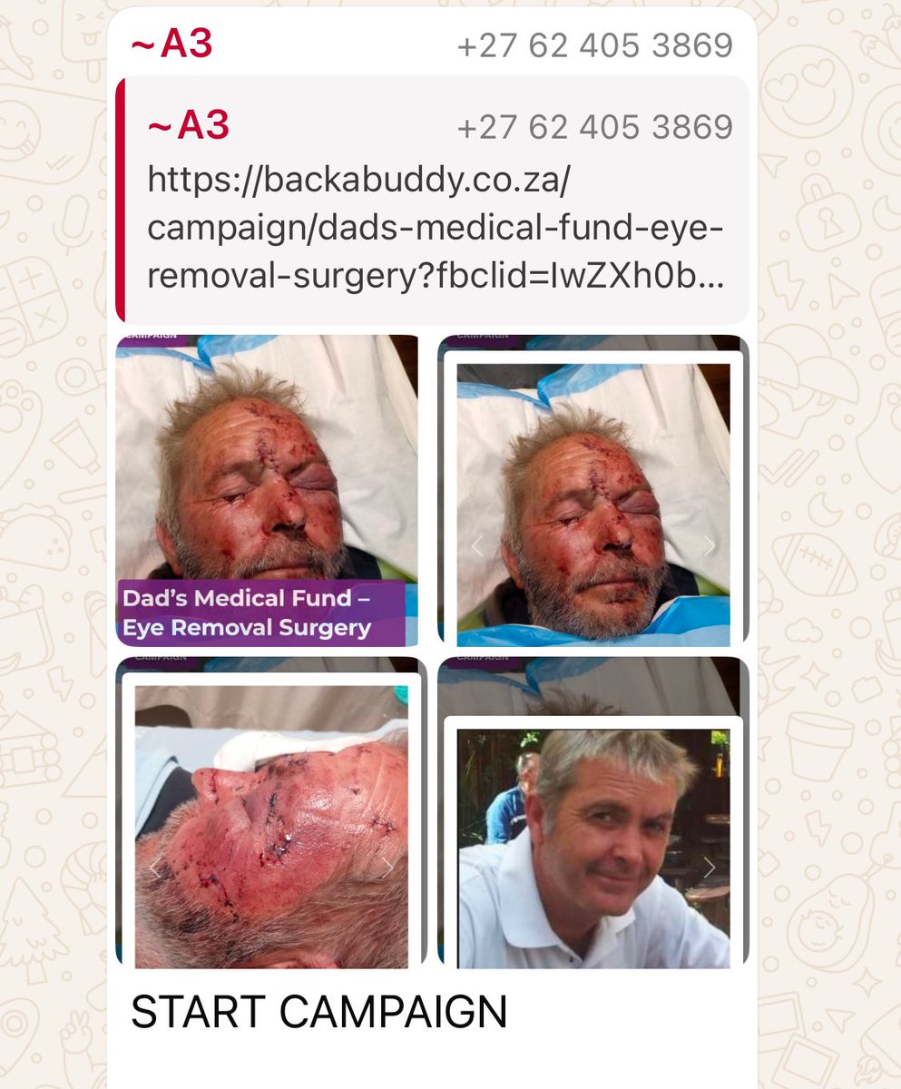 GroenOns's tweet image. Please assist a farmer in #SouthAfrica with medical costs after sustaining heinous injuries during a #FarmAttack
backabuddy.co.za/campaign/dads-…