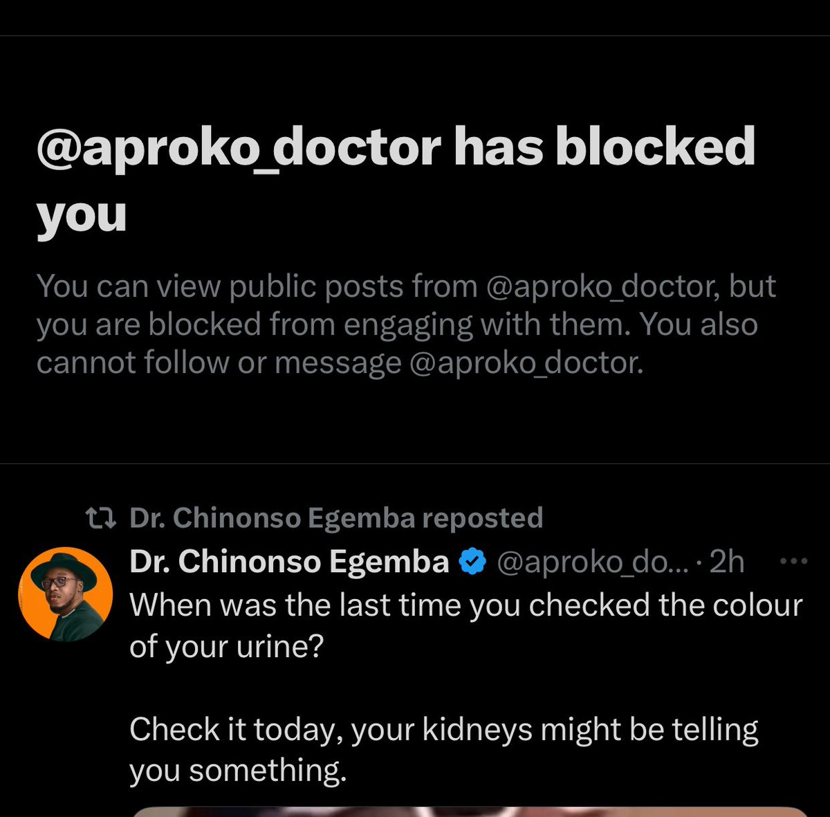 The General Snow 🇨🇮 (@generalsnow_) on Twitter photo You no go block me ke <a href="/aproko_doctor/">Dr. Chinonso Egemba</a>?
I only asked you to tell us if GMO seeds are good or bad, and instead of answering, you felt attacked.
You have actually just confirmed what many people have been saying about you .
NEXT! You no go block me ke <a href="/aproko_doctor/">Dr. Chinonso Egemba</a>?
I only asked you to tell us if GMO seeds are good or bad, and instead of answering, you felt attacked.
You have actually just confirmed what many people have been saying about you .
NEXT!