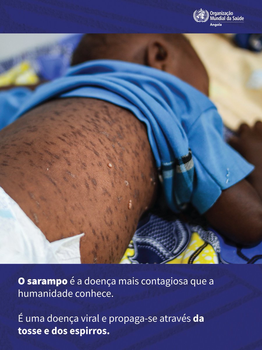 AngolaOms's tweet image. O sarampo é a doença mais contagiosa que a humanidade conhece.
Propaga-se pelo ar, causa febre, tosse e erupções na pele.
A única forma de prevenção é a vacina!
💉Vacina salva vidas! #Sarampo #Vacinação #OMSAngola