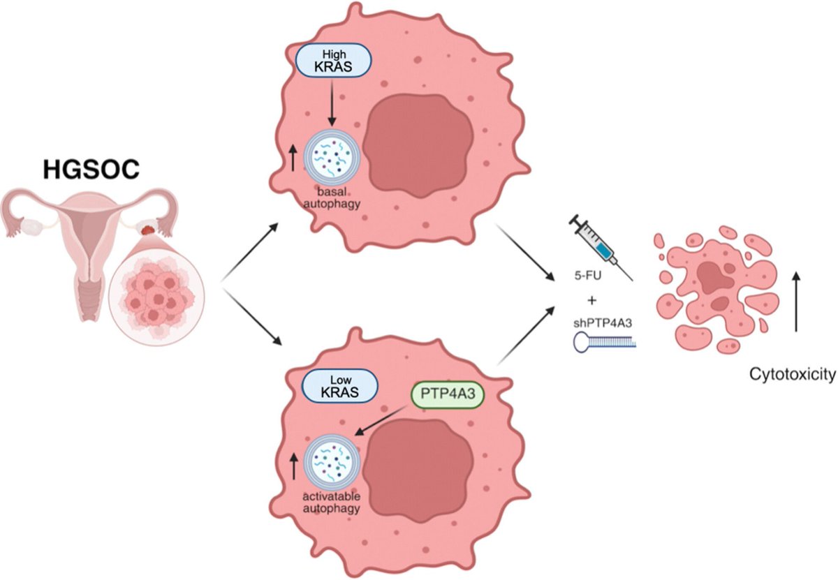 MolOncology's tweet image. Targeting of PTP4A3 overexpression sensitises HGSOC cells towards chemotherapeutic drugs
👉 buff.ly/4OGCRch
#HGSOC #Chemoresistance