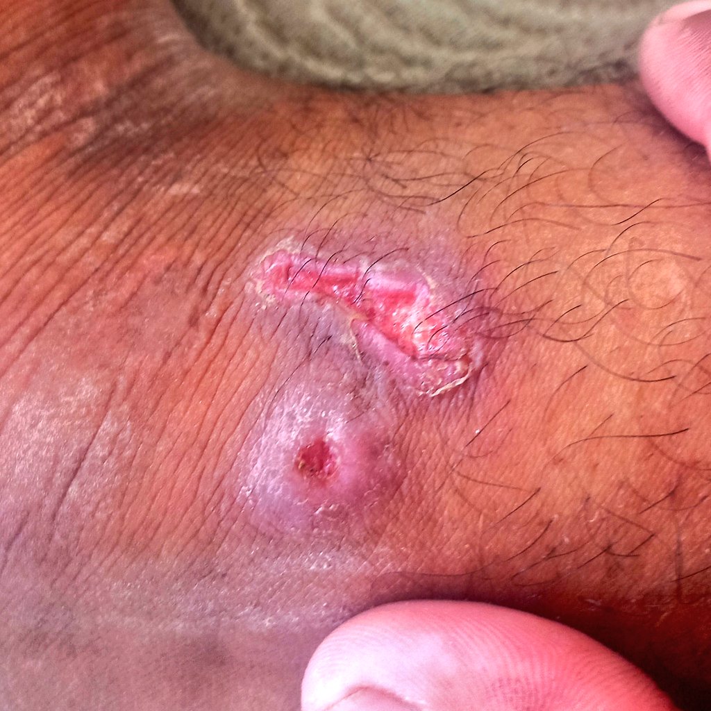 khaldonhd123's tweet image. 💔 From the heart of devastated Gaza… I cry out: Save me.
🔗 Safe donation link:
👉 chuffed.org/project/137369…
I’m a young Palestinian man, injured in my leg 🦶, unable to work, and responsible for a family of 11 👨👩👧👦.
Every day, we struggle just to find a bite to eat 🍞🥺…
We…