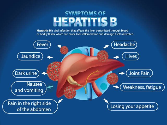 ononoherbals's tweet image. 🦠 HEPATITIS B Total Herbal REVERSAL
(Get rid of it permanently, not just viral load reduction)!
🚨 PRICE
$120 USD
₦180,000
🌍 WORLDWIDE DELIVERY 🚚
Send a DM To Order or Message me on WhatsApp directly with this link or save the number on my bio 👇…