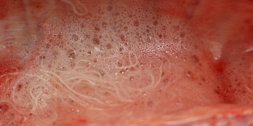 Parasitic pneumonia in cattle is caused by lungworm, Dictyocaulus viviparus. AFBI detected 2 cases  in carcasses submitted for postmortem examination in the last 2 weeks. The cattle were aged between 12 &amp; 15 months, and both were out at grass. Read more: bit.ly/4f0WYqh