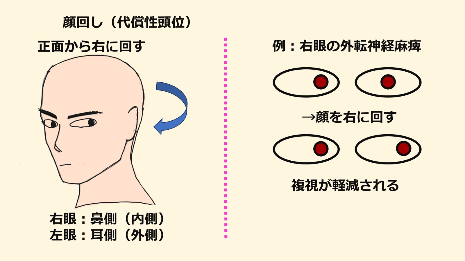 視能矯正学 img20230619185454804715.jpg?v=