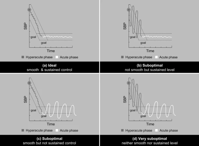 NeurocritCareJ's tweet image. Rose et al: Blood Pressure Variability After Acute Ischemic Stroke and Intracerebral Hemorrhage: Refining Its Definition, Intervention Opportunities, and Research Directions
Link: link.springer.com/article/10.100…
@neurocritical #neurocritcare