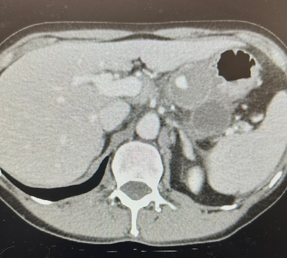 EM case of the week: Pancreas Problem
erpocketbooks.com/em-cases-41-60…