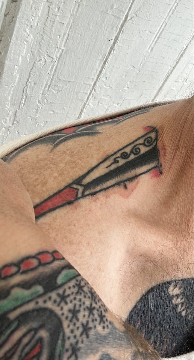 RandalHendrick9's tweet image. We tattooed some rubbing alcohol in to deal with a blowout. Pretty gnarly. I don’t know if it’s on the FDA’s radar, but it looks like it might work over time. Assuming the horror show bruising goes away and my arm doesn’t fall off, we might call this a win for folk science.