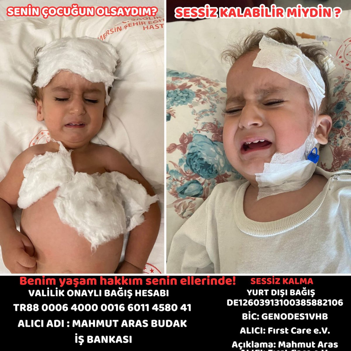 Her gördüğümde içim parçalanıyor bu çocuk için. 
Yazık ya! 
Allah için yardım edin yavrucağa. 
Son %9
Ne olur ölmesine izin vermeyin. Ne olur!