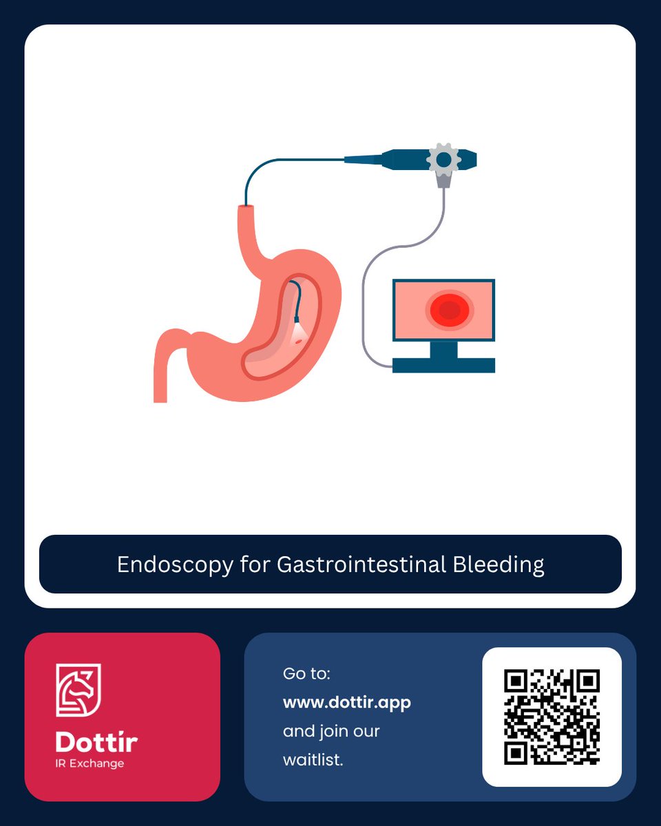 A flexible endoscope is introduced through the mouth, under sedation to visualise the upper gastrointestinal tract and locate the source of bleeding. This is usually performed by gastroenterology physicians
#Dottir #UpperGIBleed #Endoscopy #InterventionalProcedure