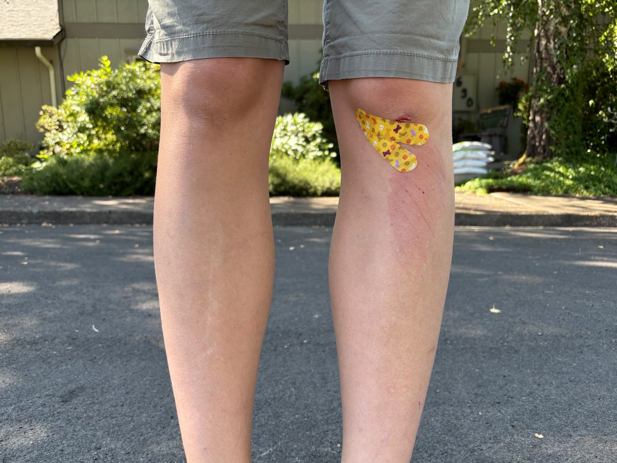 bumpasshell's tweet image. Ouch
