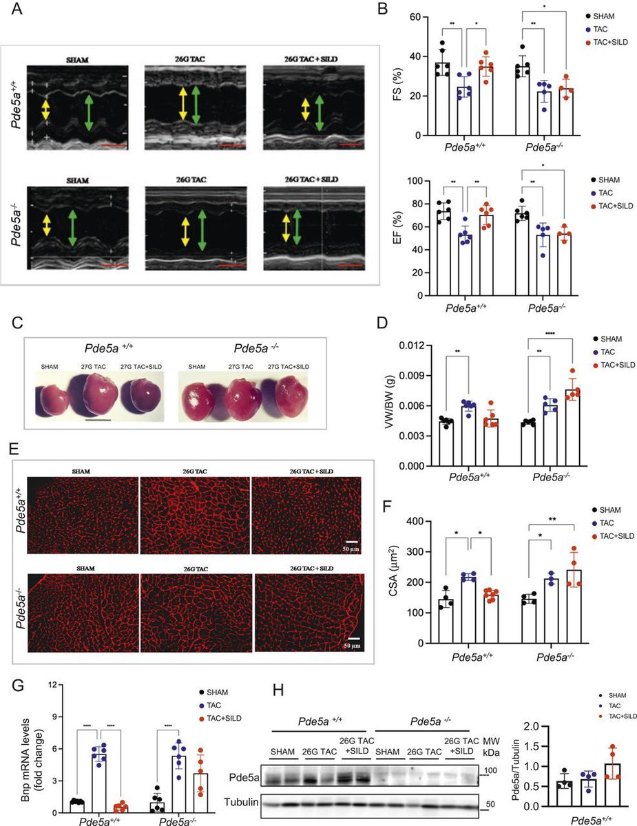 LSAjournal's tweet image. Have you seen this paper that was recently published in LSA? The rewiring of cAMP/cGMP and LDH signalling drives cardiac hypertrophy in Pde5a-/- mice @manuelapel97068; @CNRsocial_ hubs.la/Q03xrtHK0