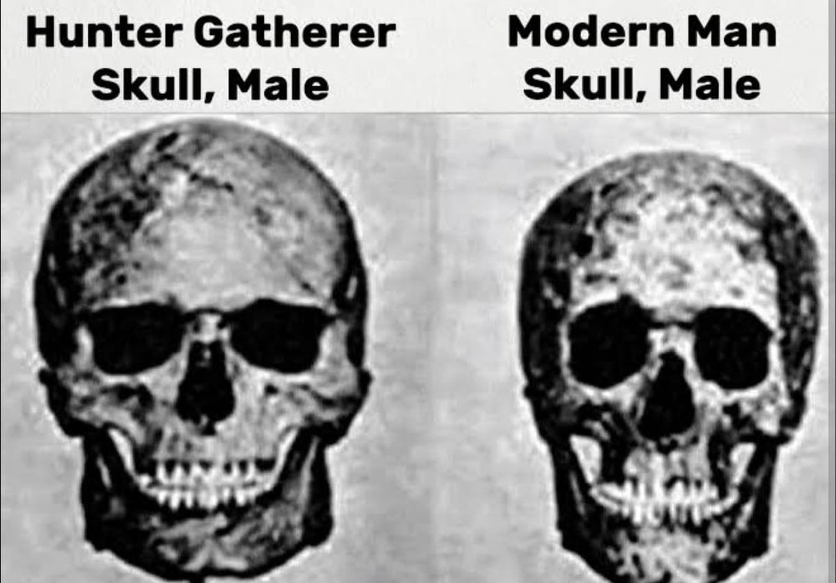 rawwellnessco's tweet image. “Just drink regular milk bro”

That’s what people say to me
While having a malformed skull, low test, and being under 6’3..