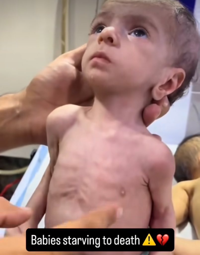 If you see this pic, reply with 🇵🇸 spread it 💔

We are starving.