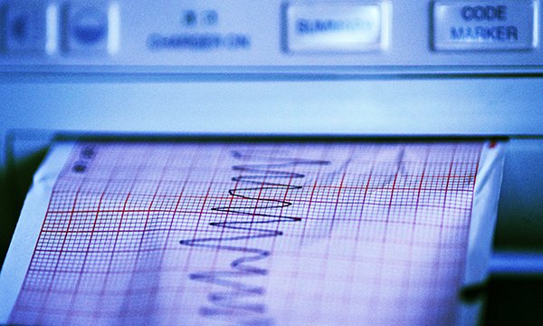 How to set up and interpret an ECG: a guide for nursing students

Click here to read advice from nurse experts &gt; rcni.com/nursing-standa…