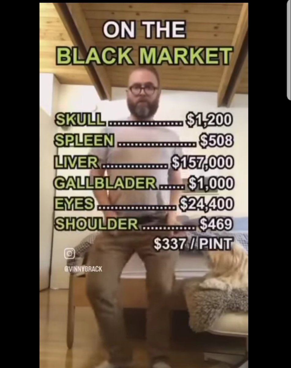 GREED753308's tweet image. Want some advice sell your Liver & Eyes you don't need both eyes 👀 and your liver definitely will Grow back invest in Sol / XPR .