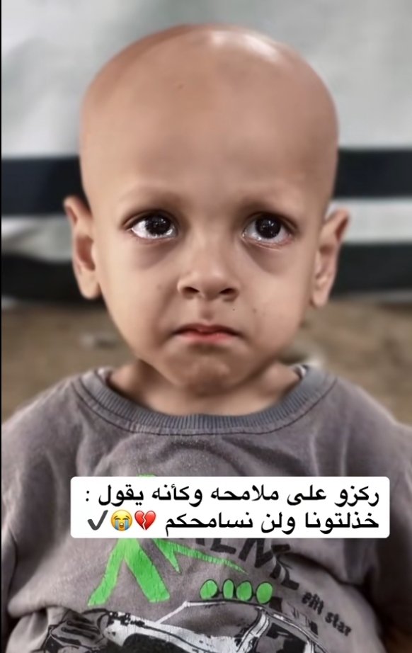m__hamidian's tweet image. "فکر کن بچه خودته و گرسنه است؛"
Imagine that it's your child and she's hungry.
#GazaStarving