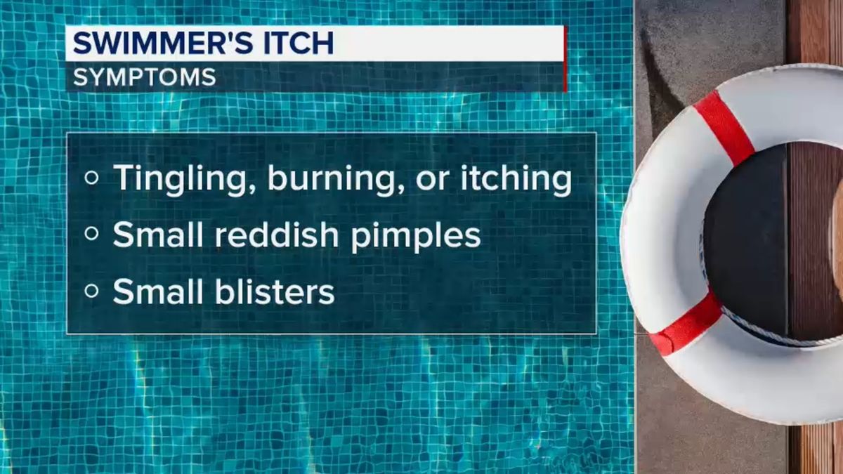 ABC7NY's tweet image. Health officials warn of Swimmer's Itch cases at Connecticut beach abc7ny.com/post/health-of…