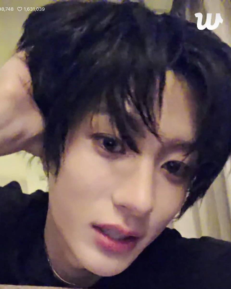NOTNA_123's tweet image. 앤똔 머리 쥐뜯쥐뜯 하더니 마지막엔 다 터져서 나감 하
머리숱많다고자랑하시는거맞죠?¿