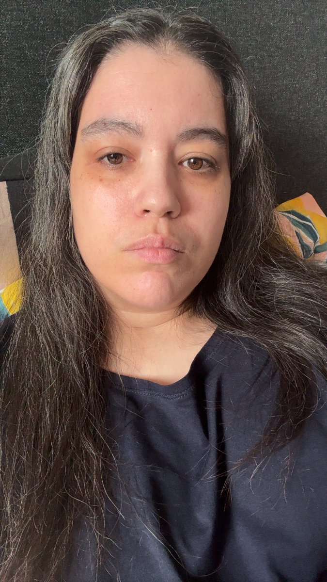 The worst thing about having chronic illnesses is the feeling like I’m gonna die. Some illnesses have progressed. I try not to show it . After my blood tests tomorrow I’ll be going A&amp;E