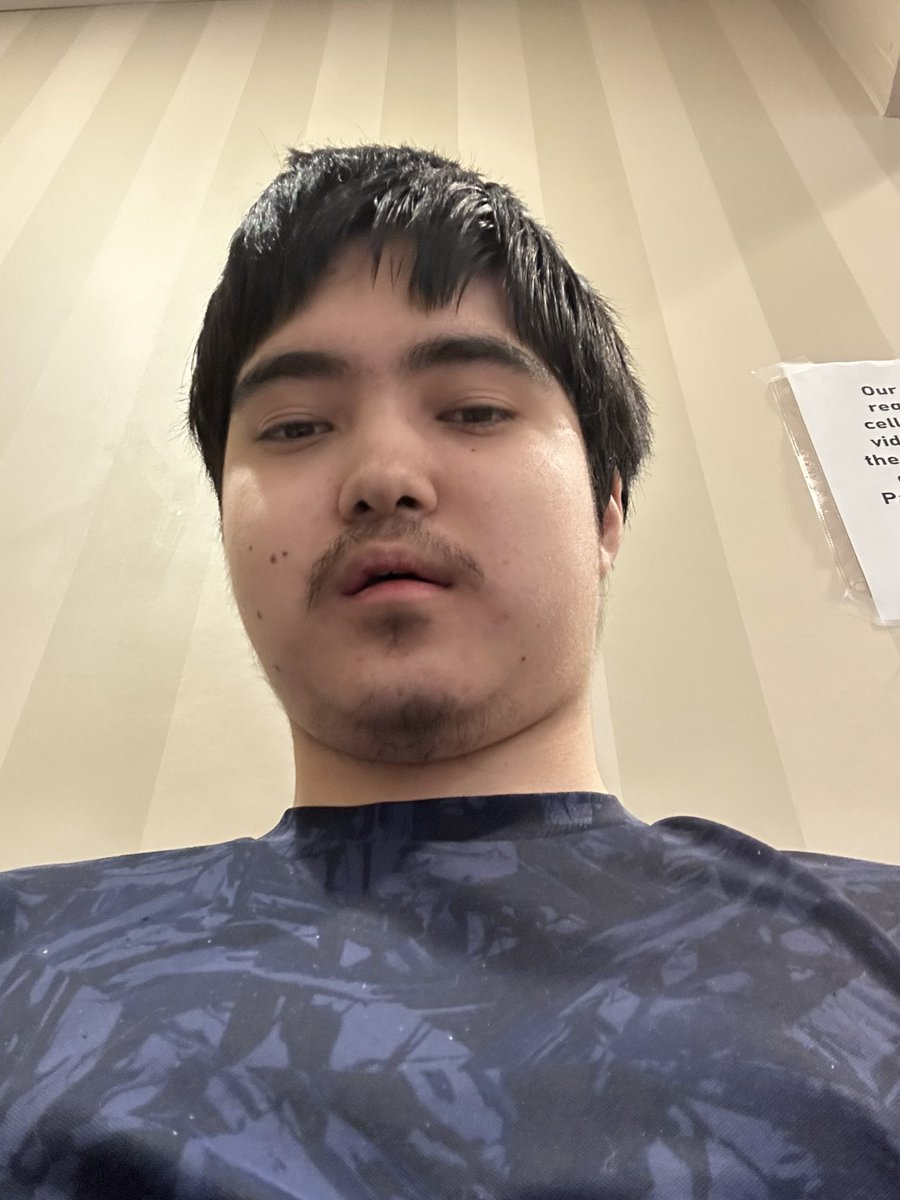 Procedure done.

Pain is a 2/10 on my jaw.