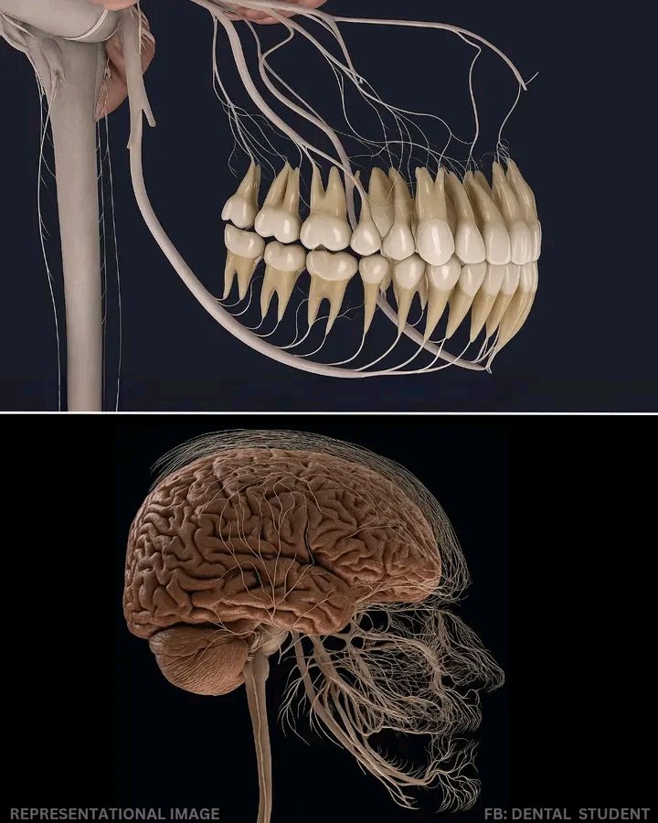 MdParagon's tweet image. 🦷 Why a Bad Tooth Hurts So Much
Decay hits the nerve.
Swelling starts.
Nowhere to go.
Pressure builds. Nerves scream.
Sharp shock ⚡ + deep throb 🔥
Your brain feels everything.
Save it early. Or root canal later.