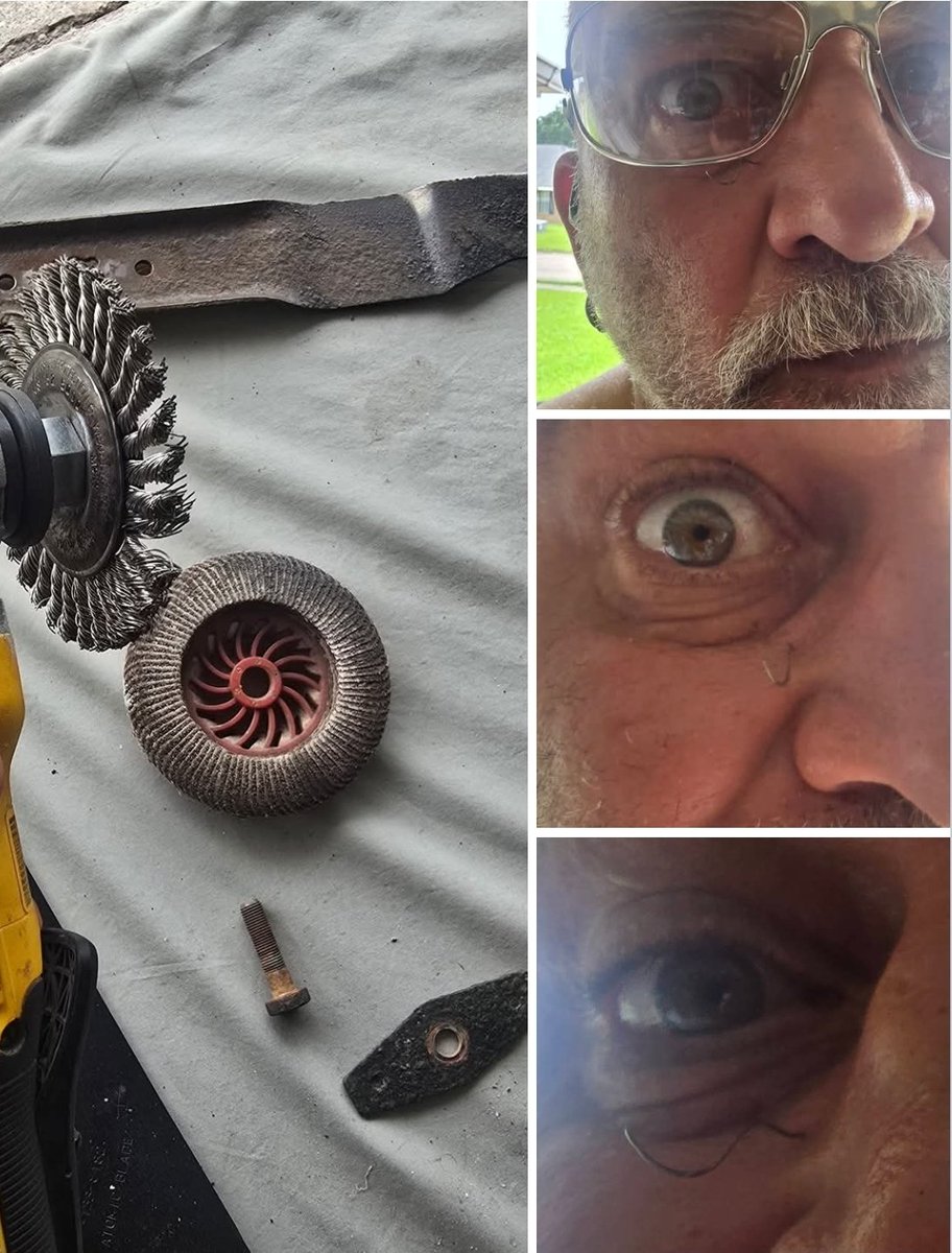 TANKsRedRocket's tweet image. I have been known to take risks, knowing I have a decent history of being lucky.🤪
One thing I never take a chance on is saftey and eye protection when using a grinder.
I ALWAYS wear safety glasses....ALWAYS.
Here's why....
Wifey, I got a booboo, I'm gonna need extra kisses…
