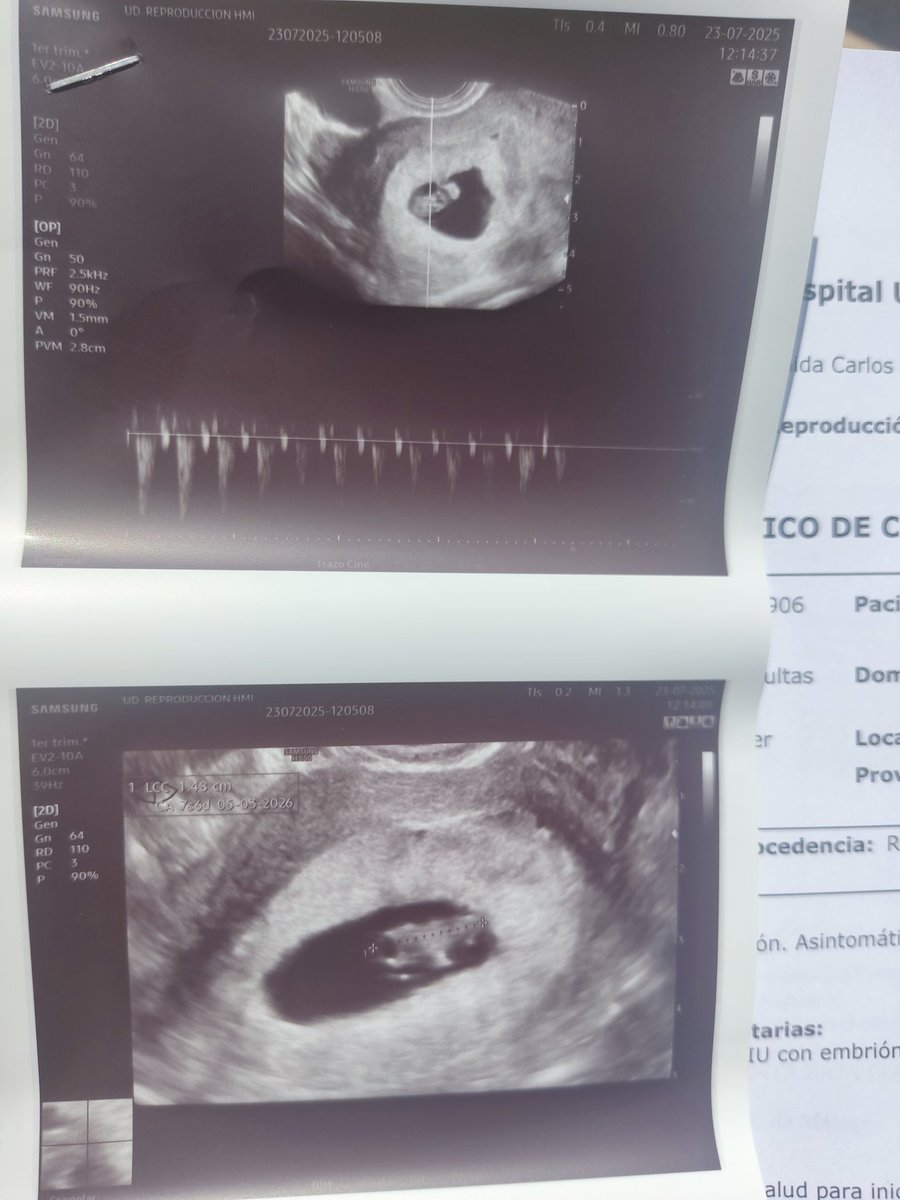 #infertilpandy ay q vértigo!Casi 6 años esperando este momento. La ecografía ha ido muy bien y hemos escuchado su corazoncito!Me han dado un informe para q vaya a mi médico de cabecera y ya me den la cartilla de embarazada. Agárrate muy fuerte 💪🙏🏻🤞🍀🫂