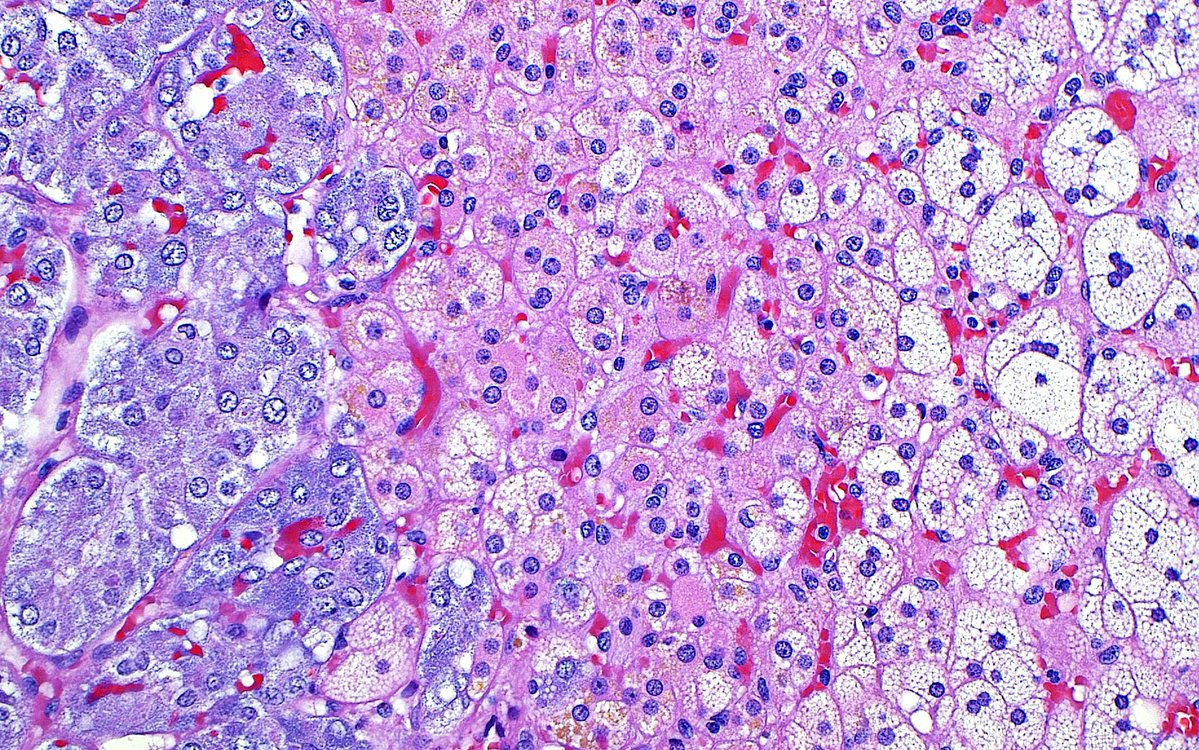🔬 Pink, White and Blue 🔴⚪️🔵 ~ Adrenal cells at the intersection of cortex (right side) and medulla (left side) ~ #Histology #Pathology #GUpath #PathArt