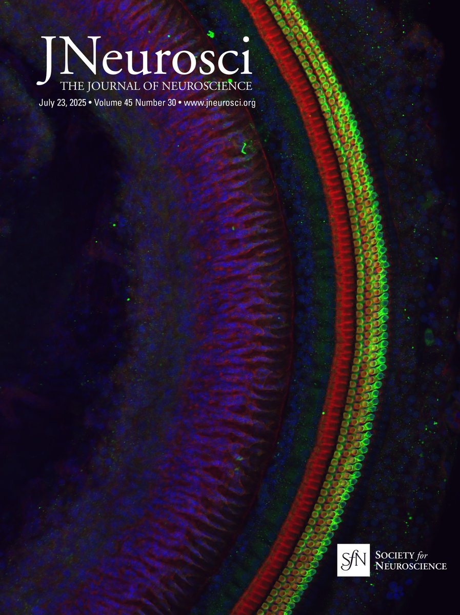 SfNJournals's tweet image. This Week in The Journal #JNeurosci | A Mechanism for Behavioral Maturation in Male Mice; Exploring Gray Matter Changes in Childhood and Adolescence
jneurosci.org/content/45/30/…