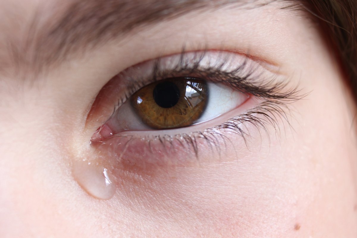 opto_advisor's tweet image. The type of #TearFilmInflammation associated with #DryEyeDisease may also factor in to the development of childhood #Myopia. Research in @AJOphthalmology
Read more: bit.ly/4o1nOmn
#Optometry #TearFilm #DryEye